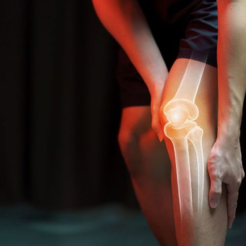 knee joint skeleton outlined on photo of person clutching their knee in pain